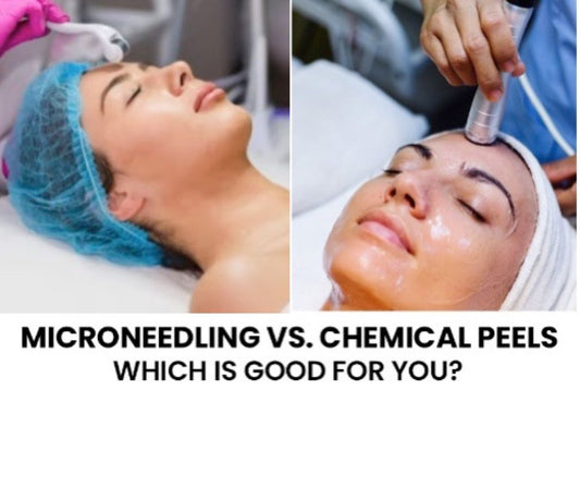 Microneedling vs. Chemical Peels: Which is Good for You?