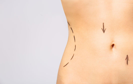 How Long Does Body Contouring Last? [Answered] - The Med SPA